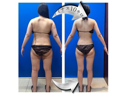 グリッター(GLITTER)の写真