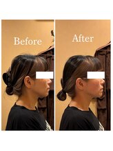 アキュレ(Acure)/