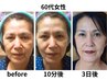 【快眠小顔整体！】結果重視の新感覚整体！お試し60分￥5500