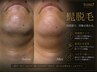 【青ヒゲ・剃刀負け対策】ヒゲ脱毛で解消！1回￥12,000→￥9,800