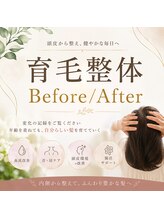 サンシー整体(SunCY整体)/育毛促進整体Before/After