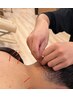 【ほぐすだけはもう古い!】オーダーメイド鍼施術+全身骨盤矯正60分¥5980