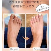 整体リード