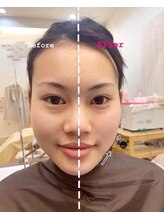 エクルビューティーツー(ECRU Beauty 2)/エクルのフェイシャル