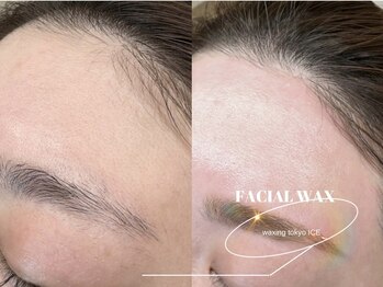 ワクシングトウキョウ アイス 池袋(waxing tokyo ice)/アイブロウ×おでこ