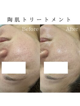 ビューティービューティー(BEAUTY BEAUTY)/