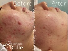 ベル 川崎(Belle)