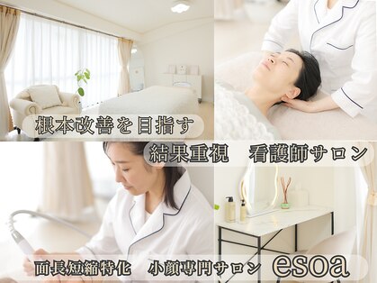 エソア(esoa)の写真