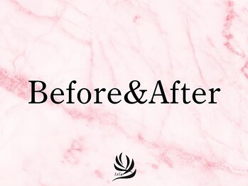 アイル(Isle)/ビフォーアフター集