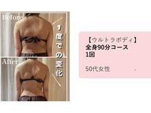 ラネージュの雰囲気（ウルトランスフォーマー筋膜ケア&ラジオ波で脂肪分解）