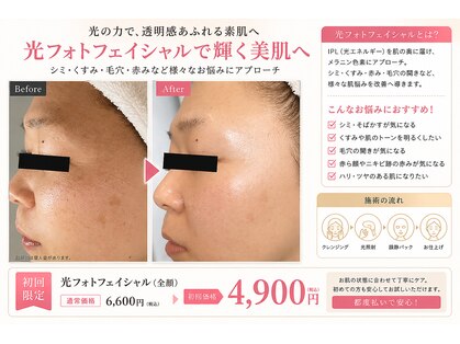 ニカ(NIKA)の写真
