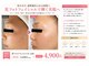 ニカ(NIKA)の写真