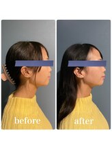 フィジオリハ 久屋大通店/美容筋膜リリース～フェイス～