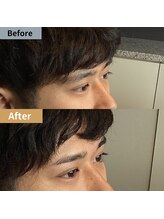 眉毛ハウス 吉祥寺店(眉毛HOUSE)/お客様の施術例(吉祥寺/東京)