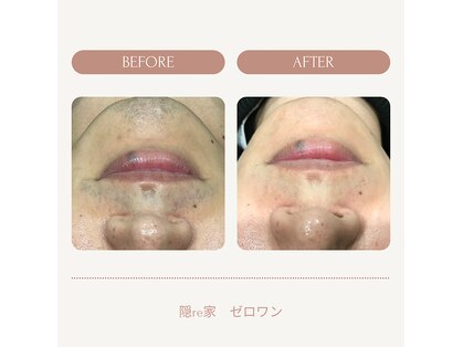 ゼロワン(0one)の写真