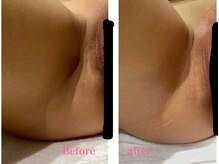 セレーネボーテプラス/