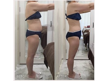 えすてさろん ケイアンドエフ(k&f)/【痩身】 4ヶ月で－10kg/40代