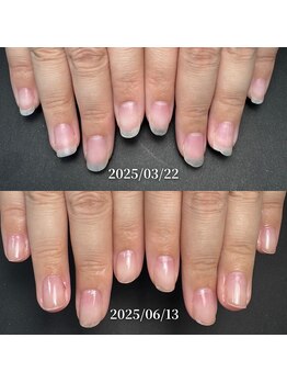 ココ(COCO)/ハンドケア・自爪育成・深爪育成