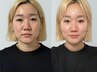 女性限定★たるみ改善★最先端マシン【テラボーラー80分】¥16,500→¥8,800