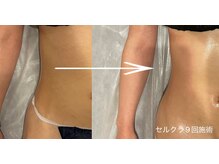 エクラ(eclat)/セルクラ