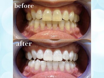 ティアラ 葛西店(TIARA)/