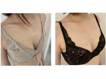美人バスト 山梨店の写真/【結果満足度◎】2026バストアップしたい人必見☆医療機関提携バストアップ専門店！体験9900円