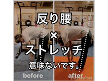 カワル整体 上通り院/ストレッチで反り腰は改善しない