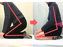 杉本接骨鍼灸院/仕事で階段を降りる時に膝に痛み