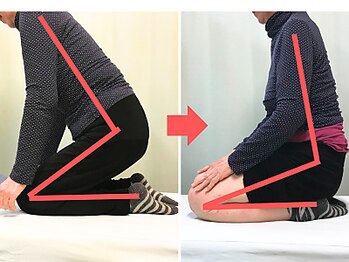 杉本接骨鍼灸院/仕事で階段を降りる時に膝に痛み