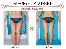 スパイア(SPIRE)/サーモシェイプDEEP★太もも