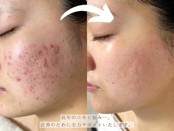 ベクラ 名古屋店(Becla)