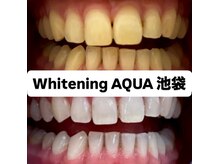 アクア 池袋店(AQUA)/ホワイトニング/池袋/東京/美白