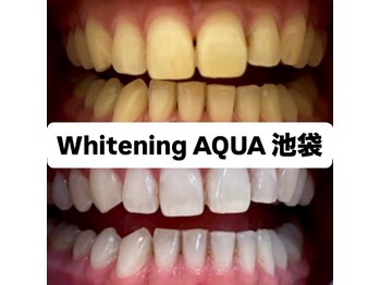 アクア 池袋店(AQUA)/ホワイトニング/池袋/東京/美白