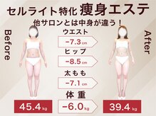 ラ パルレ 新宿新南口店/全身セルライトケア