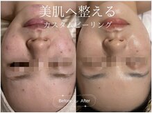 クレア(CLEA)/お肌悩みはCLEAへ ◎