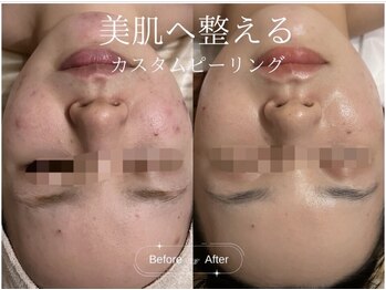 クレア(CLEA)/お肌悩みはCLEAへ ◎