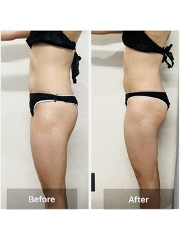 神谷澤鍼灸整骨院/before after