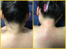 クラウン ジュエルズ(CROWN JEWELS)/【Wax脱毛】うなじ　正面 4