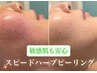 【肌に優しい/敏感肌】Newハーブピーリング×ヒト幹細胞パック付♪¥10800→