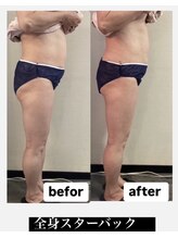 トータルビューティーサロン カノン(Kanon)/痩身コースたった1回の変化写真