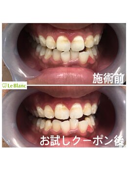 ルブラン 奈良店(Le Blanc)/男性のお客様も清潔に!