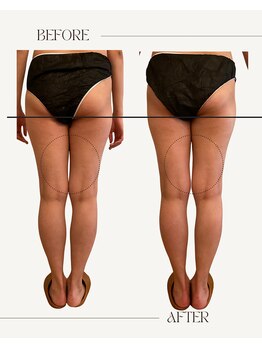 ファミーユ 名古屋店/【むくみケア】足のむくみ軽減