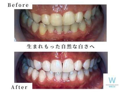 ホワイトニングショップ 南堀江店の写真