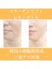 コラーゲンリフト×【高速小顔×レモンボトル】二重顎ケア・ほうれい線たるみ