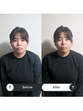 サニー(SUNNY)/小顔矯正変化2