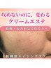春の肌荒れさん注目！限界揺らぎ肌を守りながら攻める”クリームエステ”