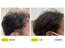 カブール 町田/髪の毛量を変える