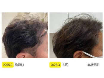 カブール 町田/髪の毛量を変える