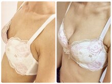 オリーブ 金沢(Olive)/バストアップ★育乳症例