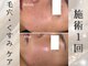プアプア(Pua Pua)の写真